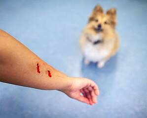 Arm med hundebid og hund i baggrunden som illustration til problemhund, aggression og ansvar